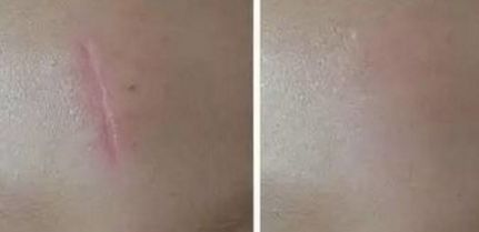 唐毅整形外科醫(yī)生胸部整形術(shù)效果如何？附最新出診信息