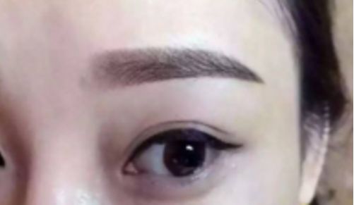 鄭州哪家整形醫(yī)院排名前五，取出異物效果好