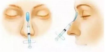 上海五位備受矚目的雙眼皮修復專家，讓你放心選擇