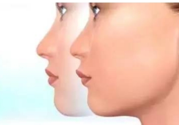 鹽城哪個醫(yī)院的光纖激光治療疤痕效果好？2023年鹽城光纖激光治療疤痕醫(yī)院排名榜TOP10！