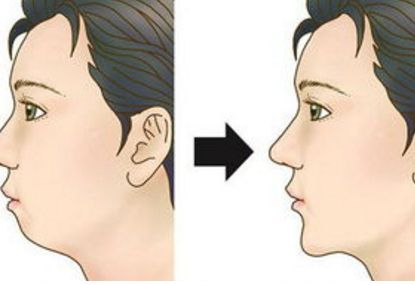 全國(guó)頂尖的鼻整復(fù)醫(yī)生排行榜