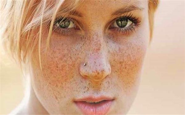 王振軍雙眼皮修復獨特個案分享，展現(xiàn)多款風格圖片！