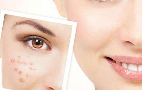 羅瀾濤醫(yī)生的鼻部整形效果如何？醫(yī)師簡(jiǎn)介與花式鼻子案例分享，價(jià)格目錄供參考