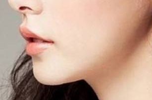 2023天津雙眼皮修復(fù)：醫(yī)生排名與技術(shù)對(duì)比，袁強(qiáng)、衛(wèi)星、李小兵等人誰更優(yōu)秀？