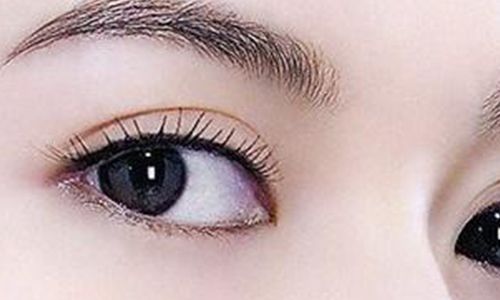 太玲美眸重現(xiàn)！揭秘雙眼皮新趨勢，驚艷效果讓人眼前一亮