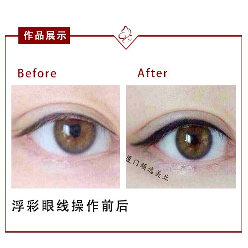 華美整形醫(yī)院在廣州口碑如何？高順福、袁耀東醫(yī)生值得信賴嗎？