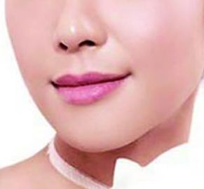 哪位西安醫(yī)生擅長割雙眼皮，割雙眼皮技術(shù)如何？