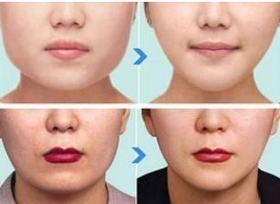 上海排名前十的公立美容醫(yī)院揭秘！技術(shù)、實(shí)力堪比私立！