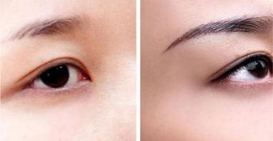 重慶頂尖眼部整形醫(yī)生、醫(yī)院排行榜一覽