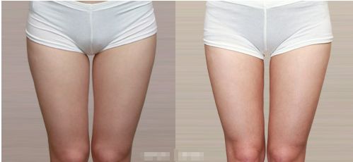 高效有效的祛斑方案，哪里選擇更好？