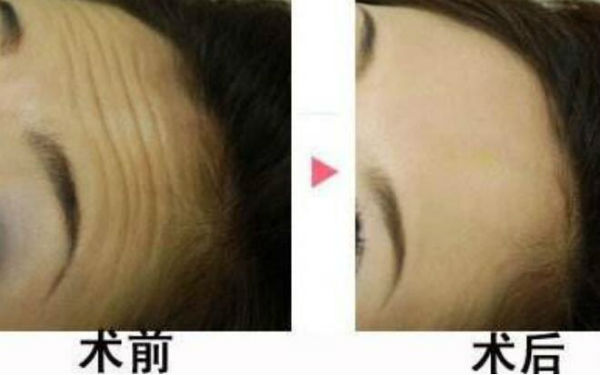 西安陽(yáng)光整形醫(yī)院靠譜嗎？醫(yī)生背景和價(jià)格怎么樣？