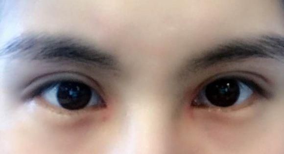 四川華西整形美容科醫(yī)生排行榜前五名，你不能錯(cuò)過的權(quán)威專家！