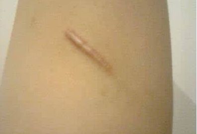 重慶最佳專(zhuān)業(yè)雙眼皮手術(shù)，醫(yī)生名單與真實(shí)案例圖震撼揭秘