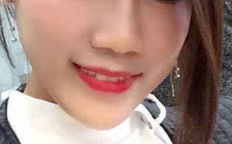 黃印資技術(shù)的鼻子風格與個人資料+隆鼻案例