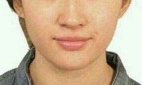 曹衛(wèi)剛vs.張超，比一比！探討九院兩位實(shí)力整形醫(yī)生的特長(zhǎng)對(duì)比