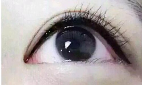 西安藝星鼻子塑造實(shí)例揭秘！2023年全新對比案例分享