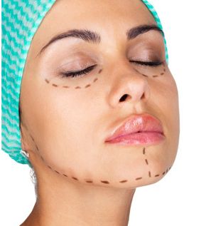 最新資訊！沈干專(zhuān)業(yè)雙眼皮技術(shù)揭秘，真實(shí)案例解析！