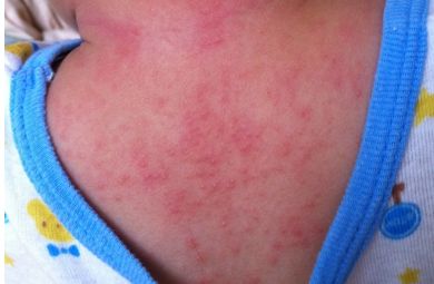 大家對(duì)重慶當(dāng)代整形醫(yī)院醫(yī)生謝錦清的技術(shù)有何評(píng)價(jià)？附有最新隆鼻案例和醫(yī)療解析