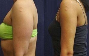 杭州最佳拉皮手術醫(yī)生盤點：十位頂尖專家為您揭秘