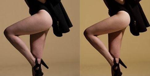 蘭州亞韓整形醫(yī)院的雙眼皮手術(shù)效果如何？親身體驗分享+手術(shù)案例解析