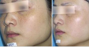 北京隆鼻醫(yī)療專家曝光！汪垟、王博謙、余恩旭等獨特風(fēng)格值得關(guān)注