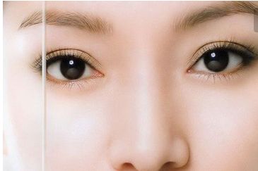 南方醫(yī)院：苗勇種植頭發(fā)的費用及效果綜述