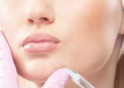 徐占鋒雙眼皮術(shù)后效果如何？專業(yè)醫(yī)生簡介及真實案例分享