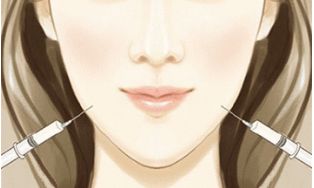 重慶醫(yī)科大學附屬第一醫(yī)院小蠻腰：雙眼皮手術無痛、自然、效果好