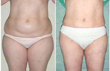 成都優(yōu)質(zhì)醫(yī)生TOP5：尋覓雙眼皮技藝精湛的專家推薦