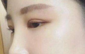 北京民航總醫(yī)院私密整形科的綜合評價(jià)