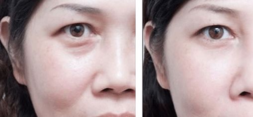 上海治療疤痕的醫(yī)院排名出爐！五家專業(yè)醫(yī)院實(shí)力震撼，趕快了解！