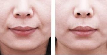 2023年南京熱門提升年輕外貌的知名醫(yī)師排行榜，更新當(dāng)?shù)貍涫苜澴u(yù)的專家醫(yī)生推薦詳細(xì)信息一覽