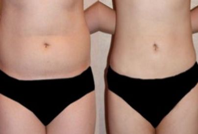 杭州哪家醫(yī)院是顴骨內(nèi)推領(lǐng)域的知名品牌？頂級醫(yī)院排行榜：浙江第一，浙江第二等梳理為參考