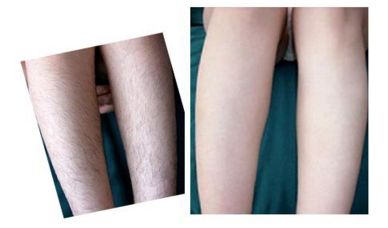 湖州整形美容醫(yī)生絕對(duì)是您值得信賴的選擇