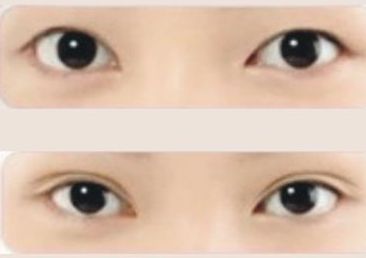 上海星璨整形醫(yī)院，專業(yè)提供驚艷隆鼻技術，擁有豐富的案例分享