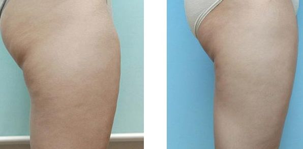 沈陽市哪家比較專業(yè)靠譜的隆鼻整形機(jī)構(gòu)值得推薦？