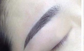 福州弗麗嘉李文信醫(yī)生：鼻部整形經(jīng)驗分享