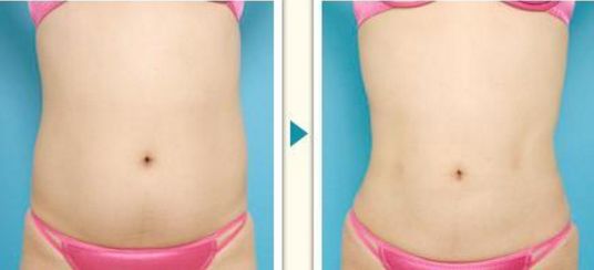 北京最受歡迎的美容院排名前三，熱門醫(yī)院名單不容錯過！