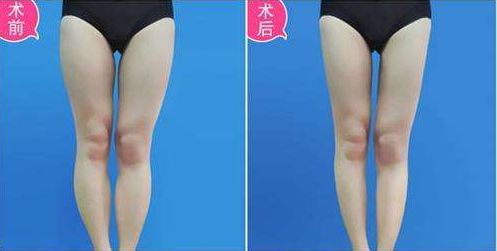 【蘇州】哪家醫(yī)院祛斑人氣高？綜合評(píng)價(jià)稱康美、維多利亞贊譽(yù)最佳！