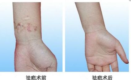 北京自體脂肪隆胸專家真實排行，專業(yè)技術(shù)精粹一同分享