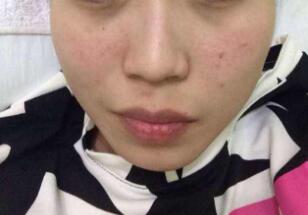 北京藝美醫(yī)療美容診所口碑怎么樣？有哪些值得推薦的醫(yī)生呢？