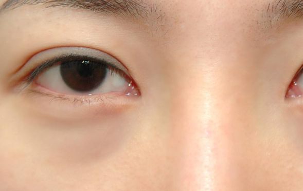 寧波臉部整形領(lǐng)域翹楚！頂尖雙眼皮醫(yī)生大揭秘