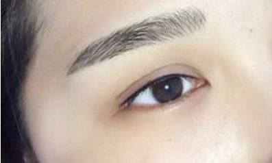 南京施爾美醫(yī)院吸脂效果好不好？南京施爾美醫(yī)院吸脂手術(shù)靠譜嗎？