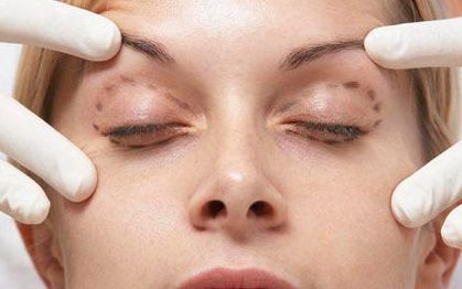 名醫(yī)徐增亮帶你解讀瑞芙臣祛痘技術，真實案例和價格信息全揭秘！