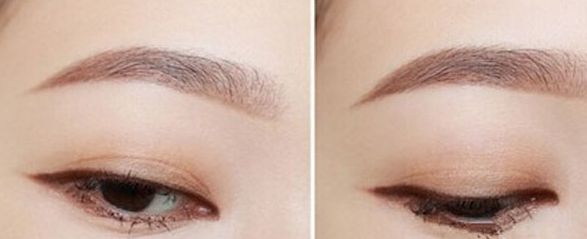 湖北哪家眼科醫(yī)院口碑最佳？這些醫(yī)院實(shí)力雄厚，贏得了廣泛贊譽(yù)。