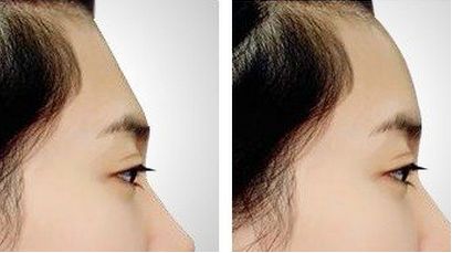 南通市最受歡迎的整形醫(yī)院推薦！在線評(píng)價(jià)說(shuō)好，真實(shí)經(jīng)驗(yàn)驚艷！