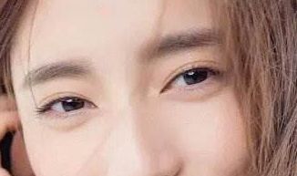 廈門盧藝樸：去眼袋術(shù)后驚艷臉龐，重拾年輕活力，醫(yī)生介紹鼎力推薦