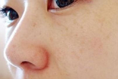 蘭州大學第二醫(yī)院私密整形部門案例揭示，充滿驚喜！