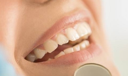 銀川哪家醫(yī)院有專業(yè)的熱瑪吉技術祛黑眼圈？2023年最新排名出爐，趕緊看看前十名單！