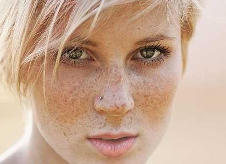 沈陽協(xié)和醫(yī)院受歡迎的雙眼皮手術(shù)2023案例分享